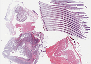 thumbnail for the slide P1 scan A
