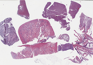 thumbnail for the slide P1 scan B
