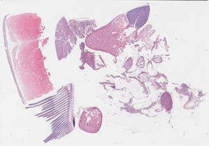 thumbnail for the slide P4